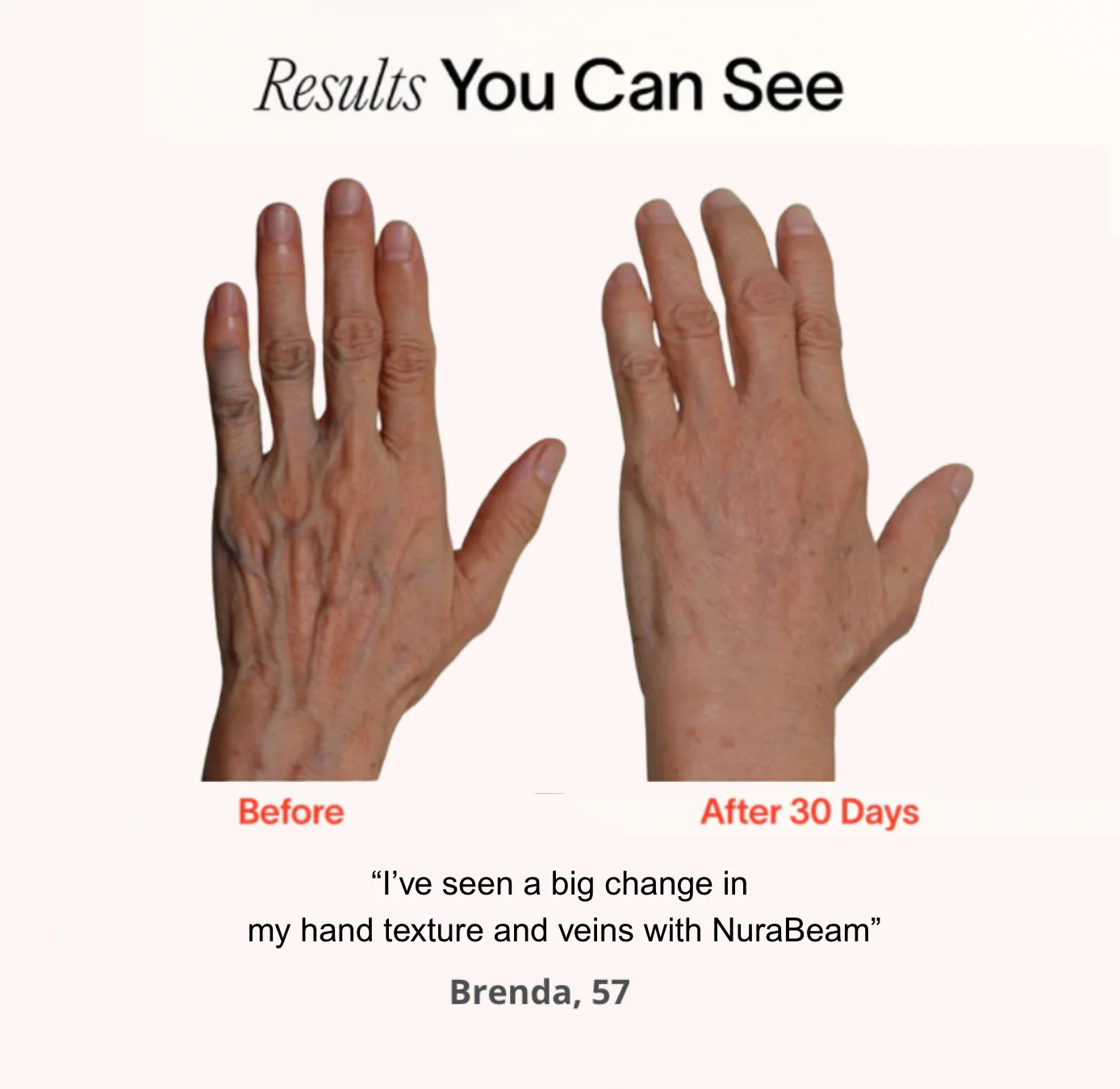 NuraRenewal™ Hand Glove - Image 3