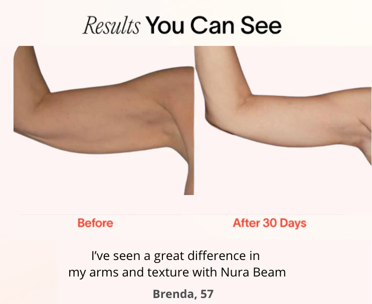 NuraSculpt™ Arm Band_ - Image 3