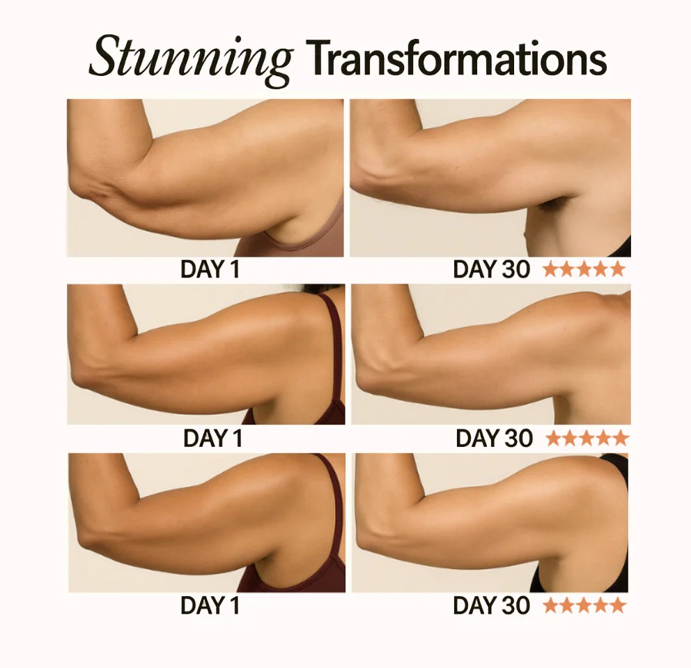 NuraSculpt™ Arm Band_ - Image 8