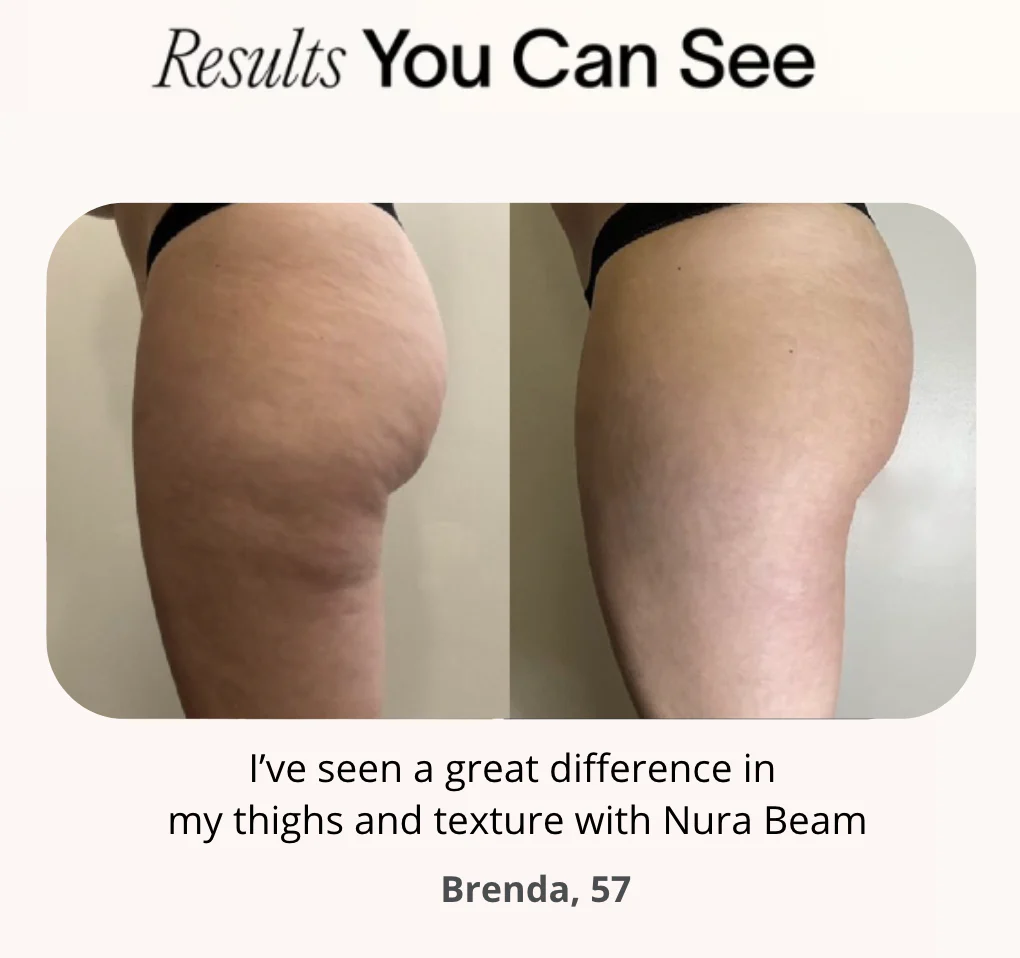 NuraSculpt™ Thigh Band - Image 4